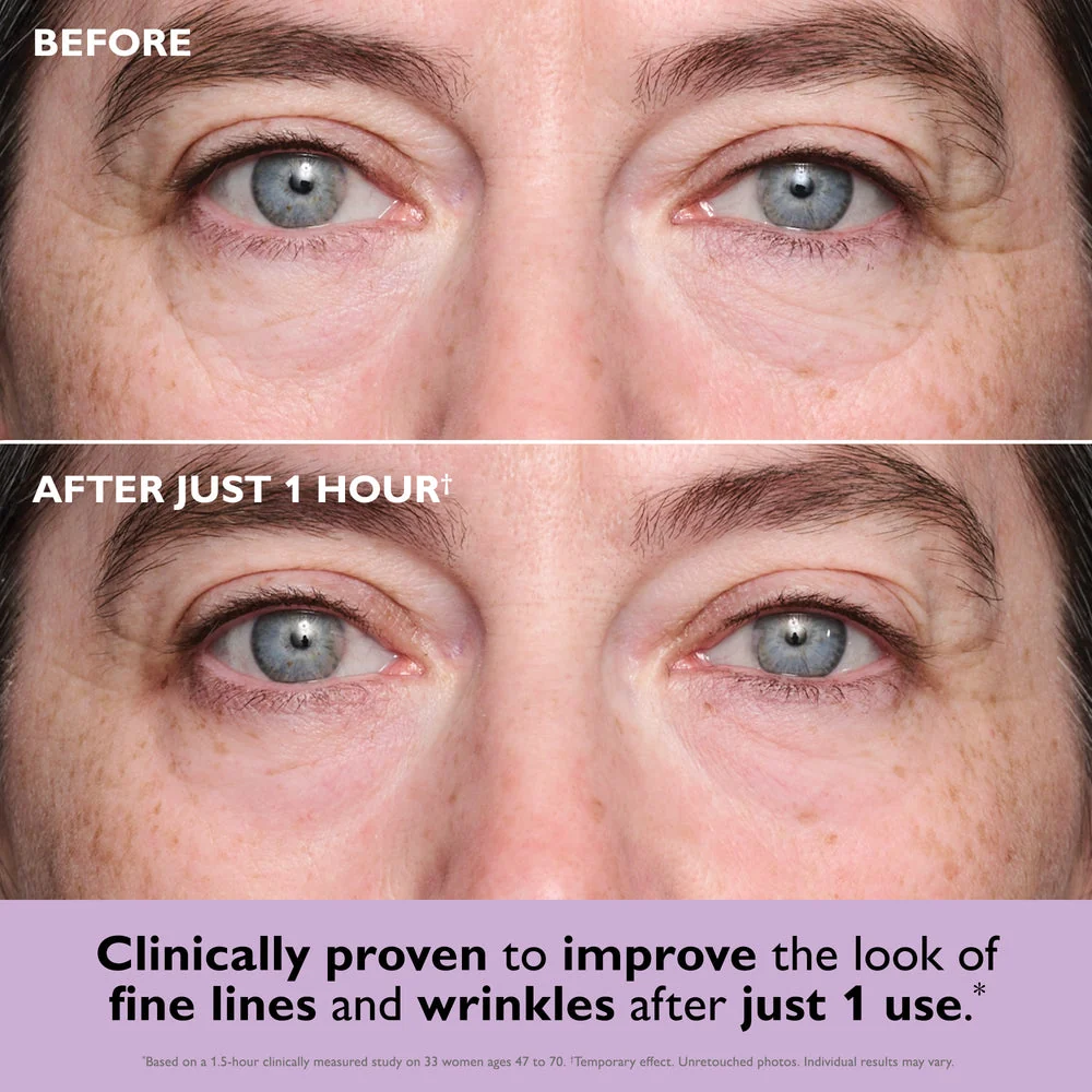 Peter Thomas Roth Instant FIRMx Collagen Infusion Tightening Eye Patches - Image 2