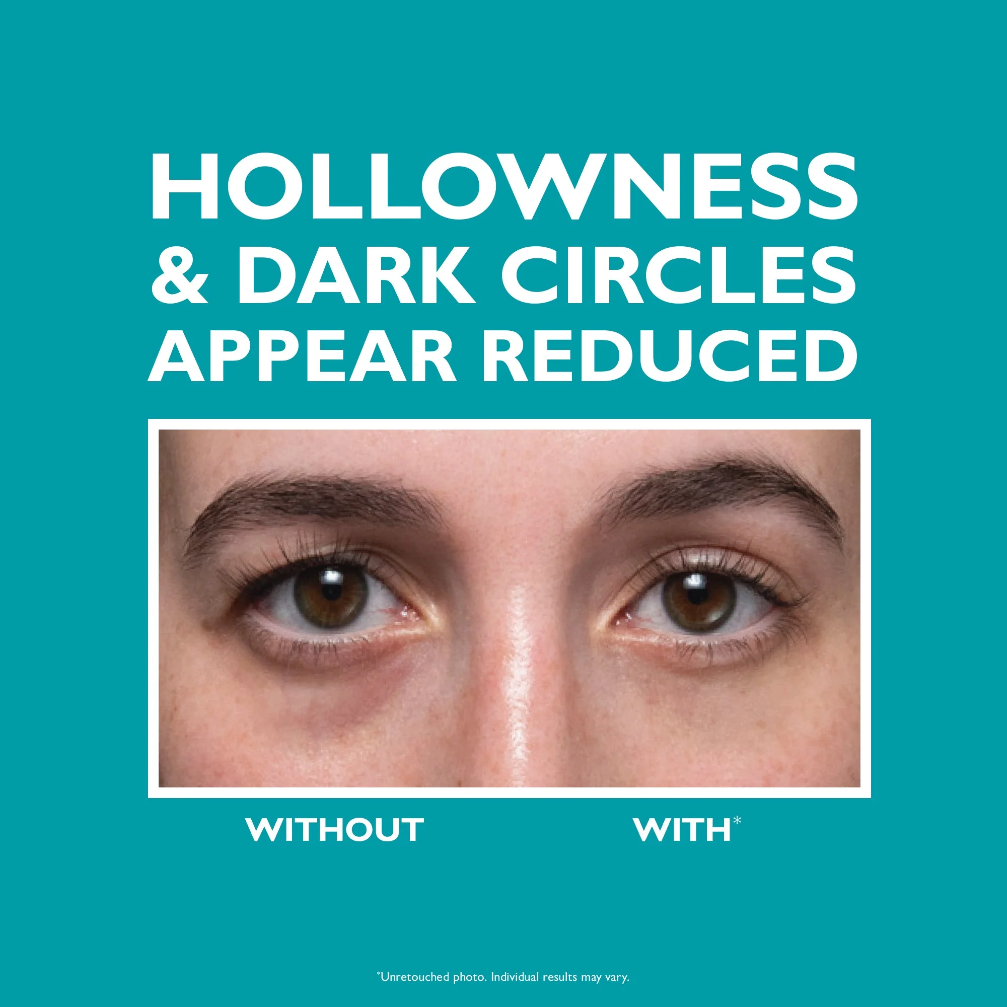 Peter Thomas Roth Peptide Skinjection Fill + Fix Under Eye Cream - Image 4