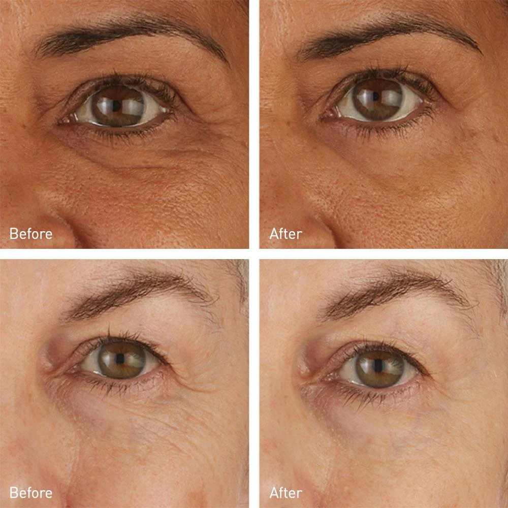Skyn Iceland Hydro Cool Firming Eye Gels - Image 4