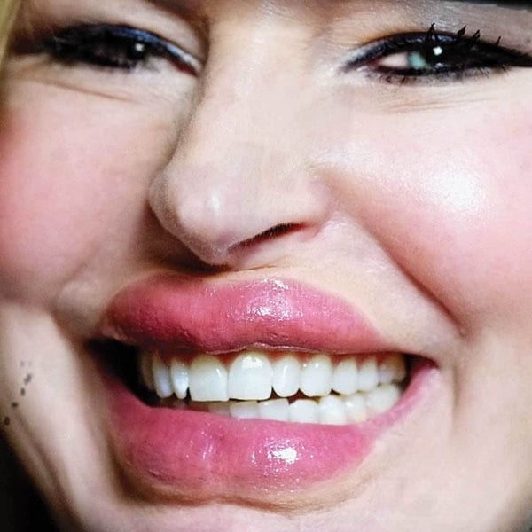 Tinsley Transfers Botoxic Lips - 3D FX Transfer - Image 3