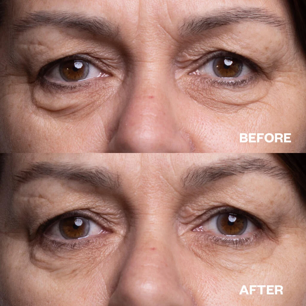 Wrinkles Schminkles Eye Wrinkle Patches - 3 Pairs - Image 4
